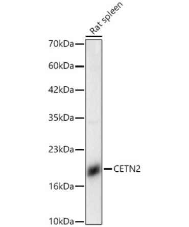 CETN2 Rabbit Polyclonal Antibody