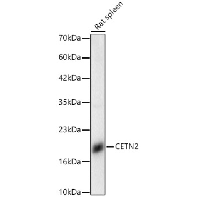 CETN2 Rabbit Polyclonal Antibody