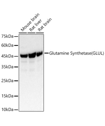 Glutamine Synthetase (GLUL) Rabbit Polyclonal Antibody