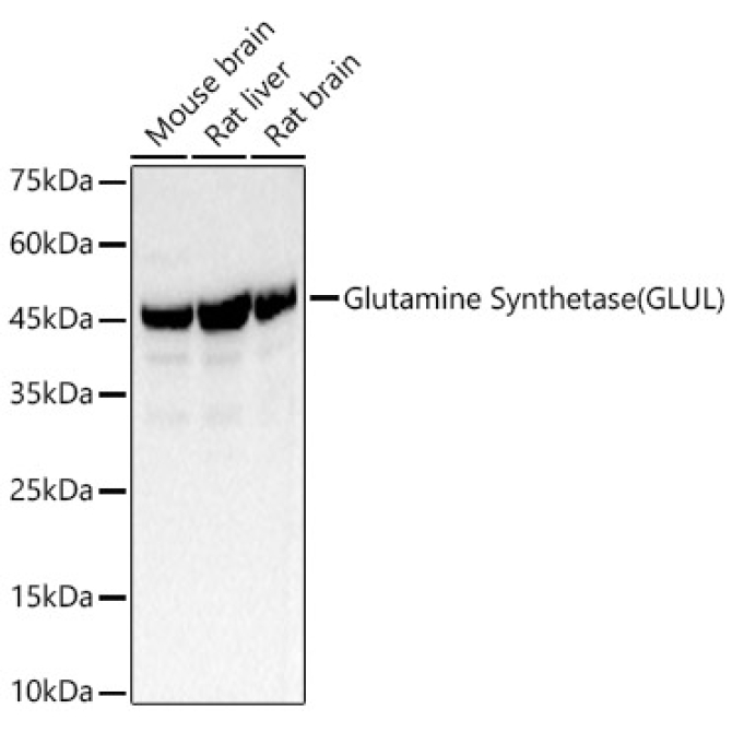 Glutamine Synthetase (GLUL) Rabbit Polyclonal Antibody
