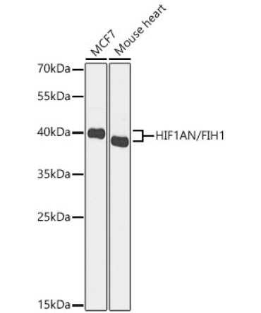 HIF1AN/FIH1 Rabbit Polyclonal Antibody