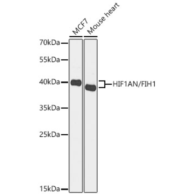 HIF1AN/FIH1 Rabbit Polyclonal Antibody