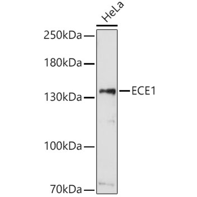 ECE1 Rabbit Polyclonal Antibody