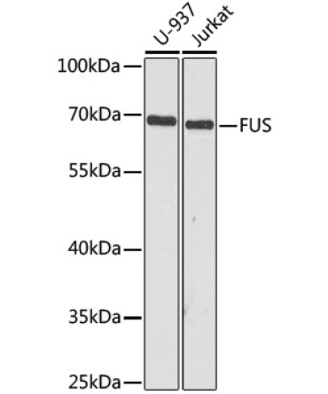 FUS Rabbit Polyclonal Antibody