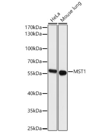 MST1 Rabbit Polyclonal Antibody