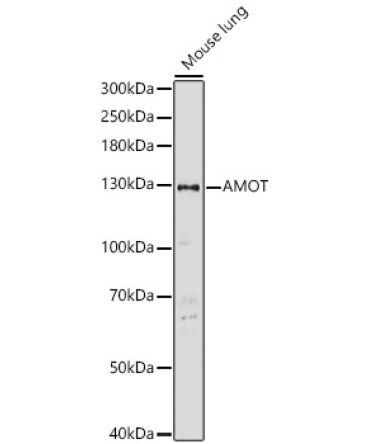 AMOT Rabbit Polyclonal Antibody