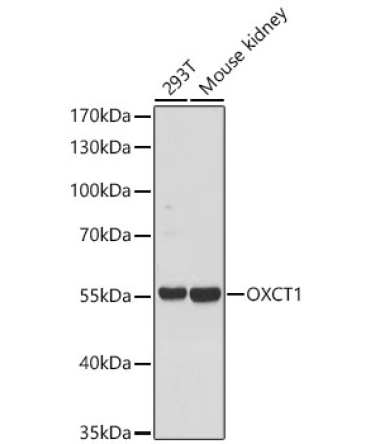 OXCT1 Rabbit Polyclonal Antibody