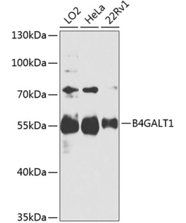 B4GALT1 Rabbit Polyclonal Antibody