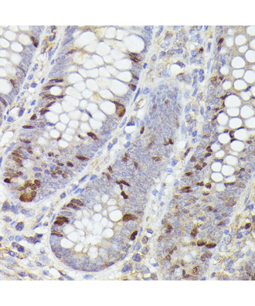 Ki67 Rabbit Monoclonal Antibody