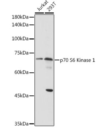 p70 S6 Kinase 1 Rabbit Polyclonal Antibody