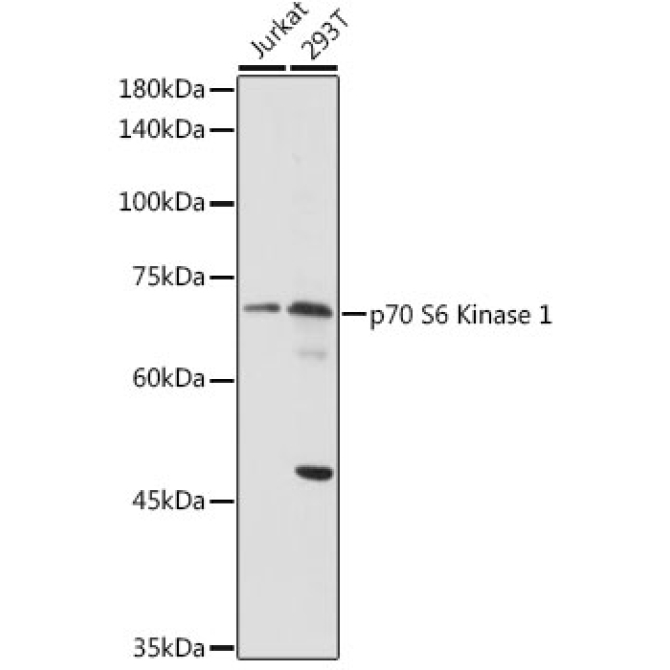 p70 S6 Kinase 1 Rabbit Polyclonal Antibody