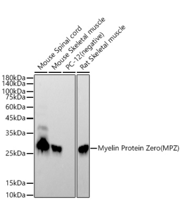Myelin Protein Zero (MPZ) Rabbit Monoclonal Antibody