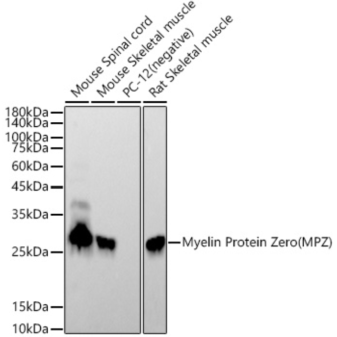 Myelin Protein Zero (MPZ) Rabbit Monoclonal Antibody