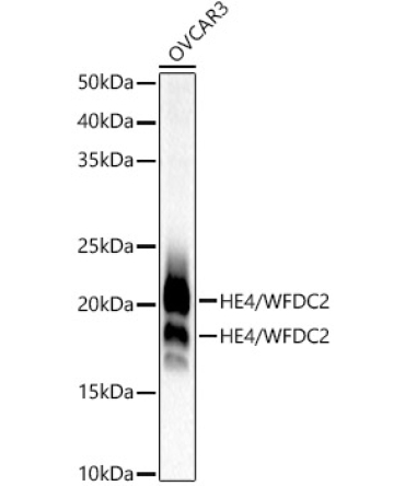 HE4/WFDC2 Rabbit Monoclonal Antibody