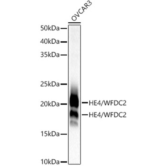 HE4/WFDC2 Rabbit Monoclonal Antibody