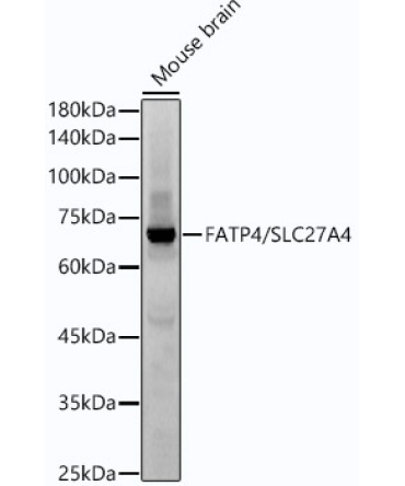 FATP4/SLC27A4 Rabbit Monoclonal Antibody