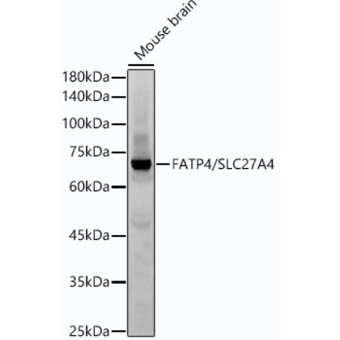 FATP4/SLC27A4 Rabbit Monoclonal Antibody