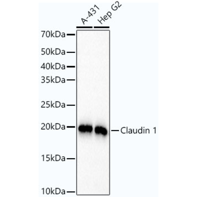 Claudin 1 Rabbit Monoclonal Antibody [KO Validated]