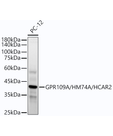 GPR109A/HM74A/HCAR2 Rabbit Monoclonal Antibody