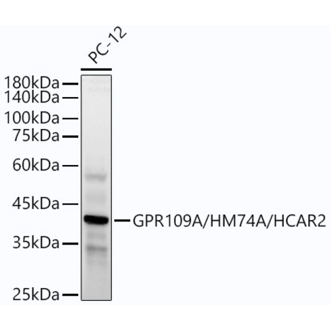 GPR109A/HM74A/HCAR2 Rabbit Monoclonal Antibody