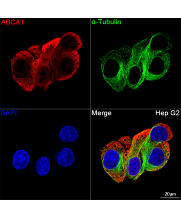 ABCA1 Rabbit Monoclonal Antibody