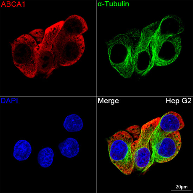 ABCA1 Rabbit Monoclonal Antibody