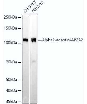 Alpha2-adaptin/AP2A2 Rabbit Monoclonal Antibody