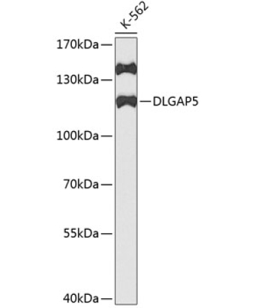 DLGAP5 Rabbit Polyclonal Antibody