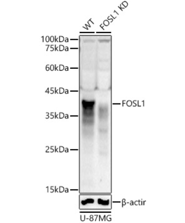 FOSL1 Rabbit Polyclonal Antibody [KD Validated]