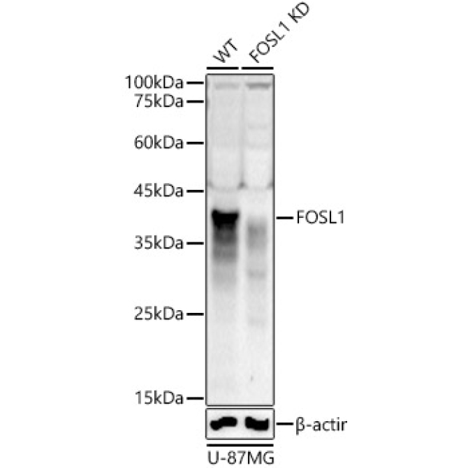 FOSL1 Rabbit Polyclonal Antibody [KD Validated]