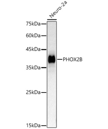 PHOX2B Rabbit Polyclonal Antibody [KD Validated]