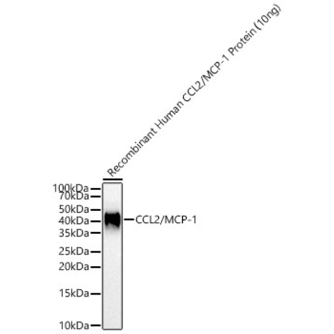 CCL2/MCP-1 Rabbit Polyclonal Antibody