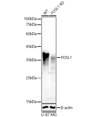 FOSL1 Rabbit Polyclonal Antibody [KD Validated]