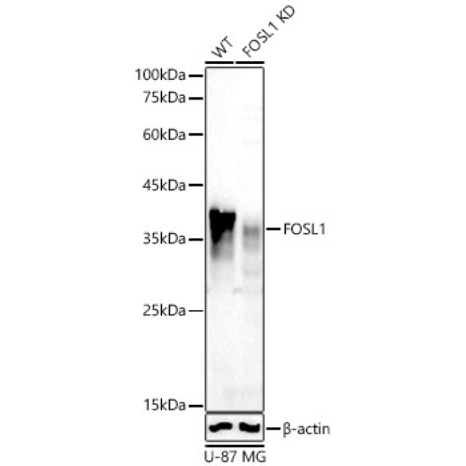 FOSL1 Rabbit Polyclonal Antibody [KD Validated]