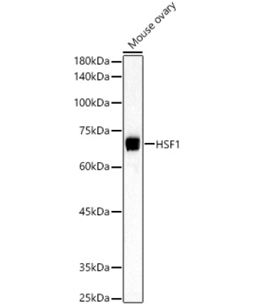 HSF1 Rabbit Polyclonal Antibody