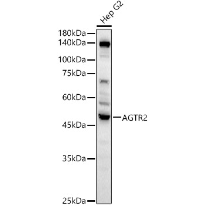AGTR2 Rabbit Polyclonal Antibody
