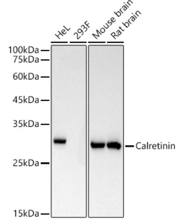 Calretinin Rabbit Monoclonal Antibody
