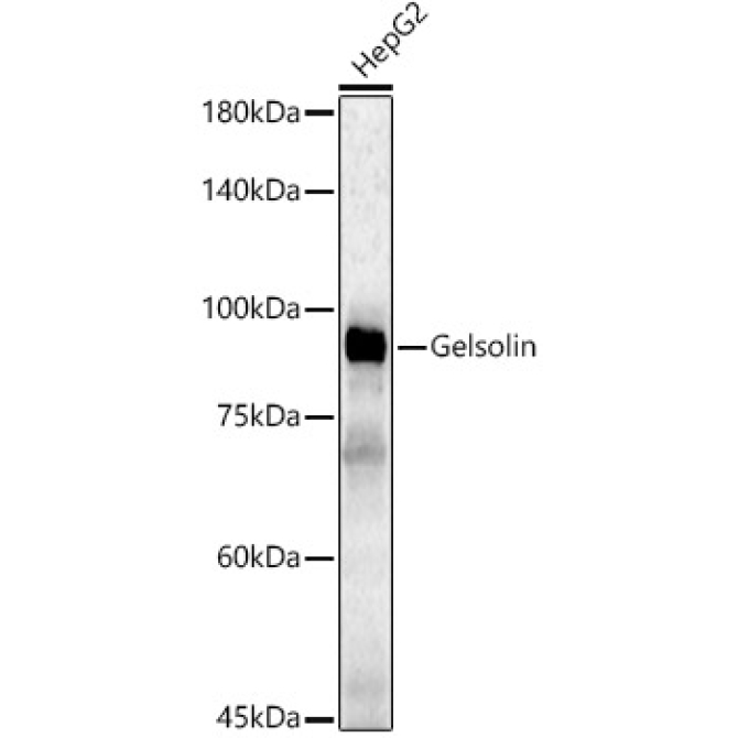 Gelsolin Rabbit Polyclonal Antibody [KD Validated]