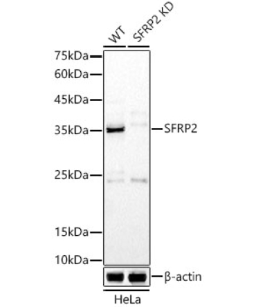 SFRP2 Rabbit Polyclonal Antibody [KD Validated]