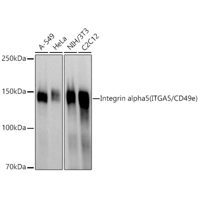Integrin alpha 5 (ITGA5/CD49e) Rabbit Polyclonal Antibody