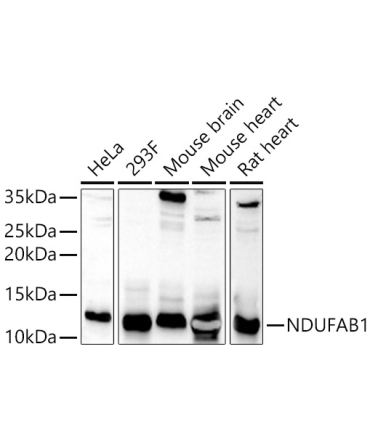 NDUFAB1 Rabbit Polyclonal Antibody