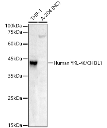 Human YKL-40/CHI3L1 Rabbit Polyclonal Antibody
