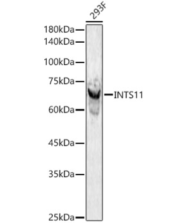 INTS11 Rabbit Polyclonal Antibody