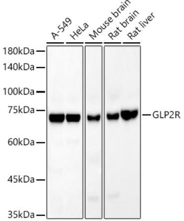 GLP2R Rabbit Monoclonal Antibody