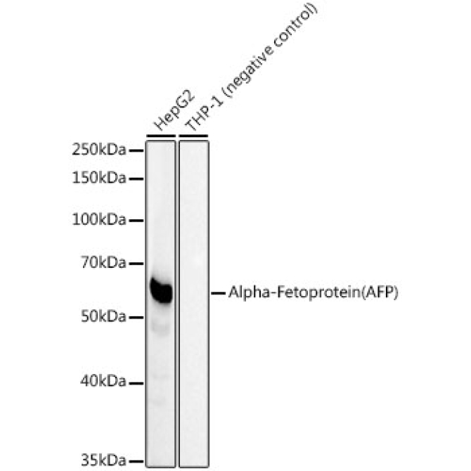 Alpha-Fetoprotein (AFP) Rabbit Monoclonal Antibody