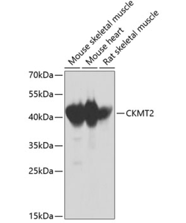 CKMT2 Rabbit Polyclonal Antibody