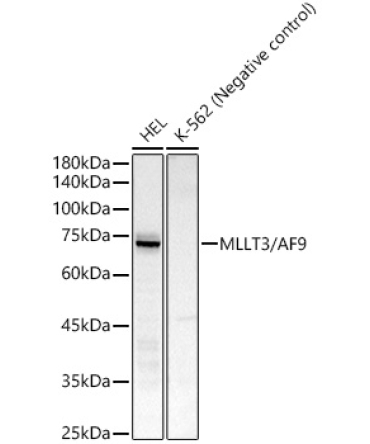 MLLT3/AF9 Rabbit Monoclonal Antibody