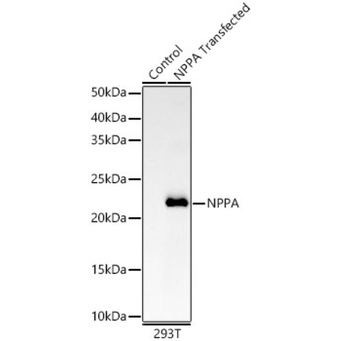 NPPA Rabbit Monoclonal Antibody