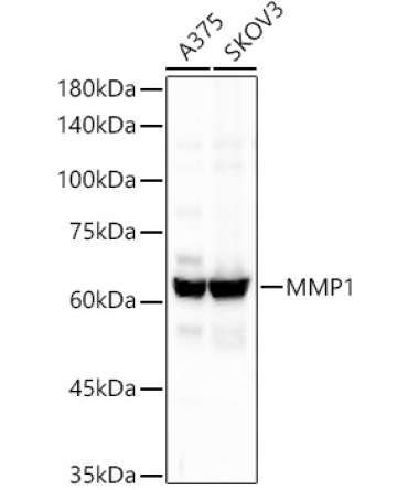 MMP1 Rabbit Monoclonal Antibody