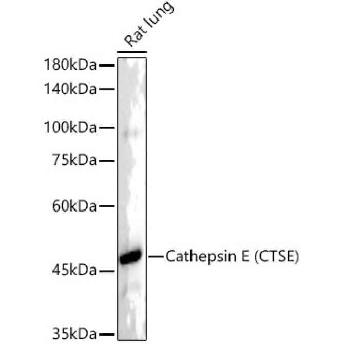 Cathepsin E (CTSE) Rabbit Monoclonal Antibody